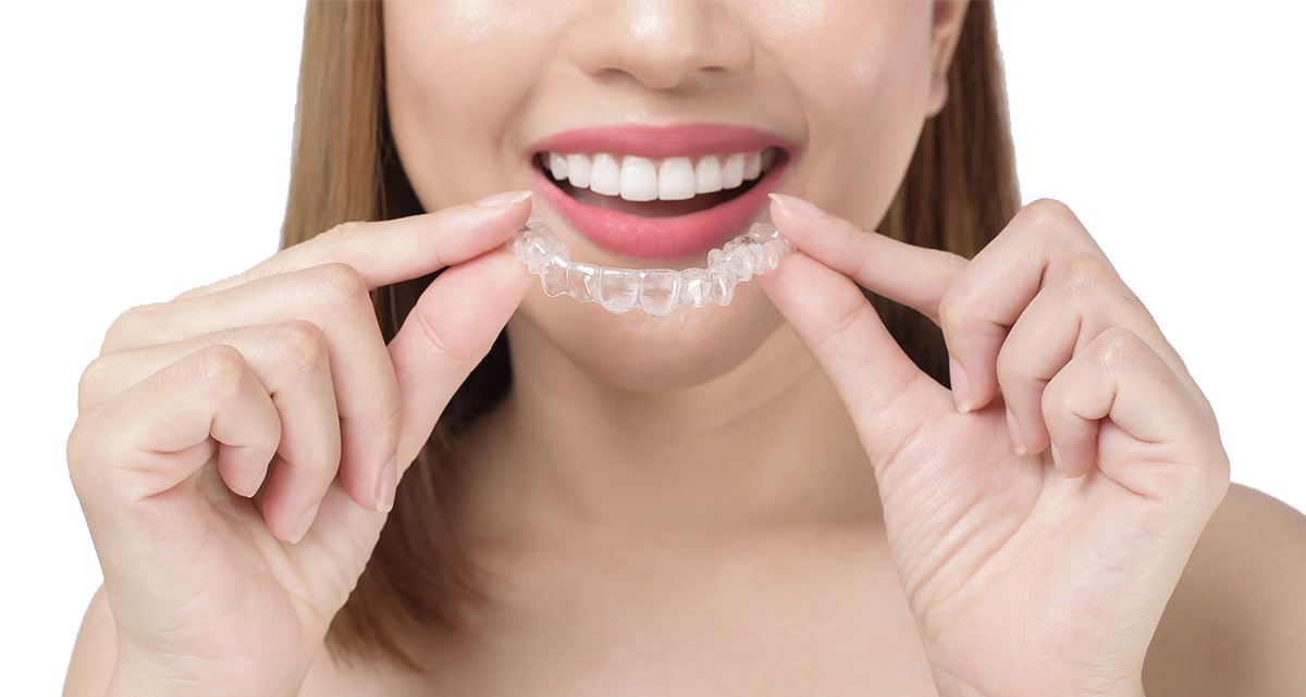 Clear Aligners treatment in Wakad, Pune